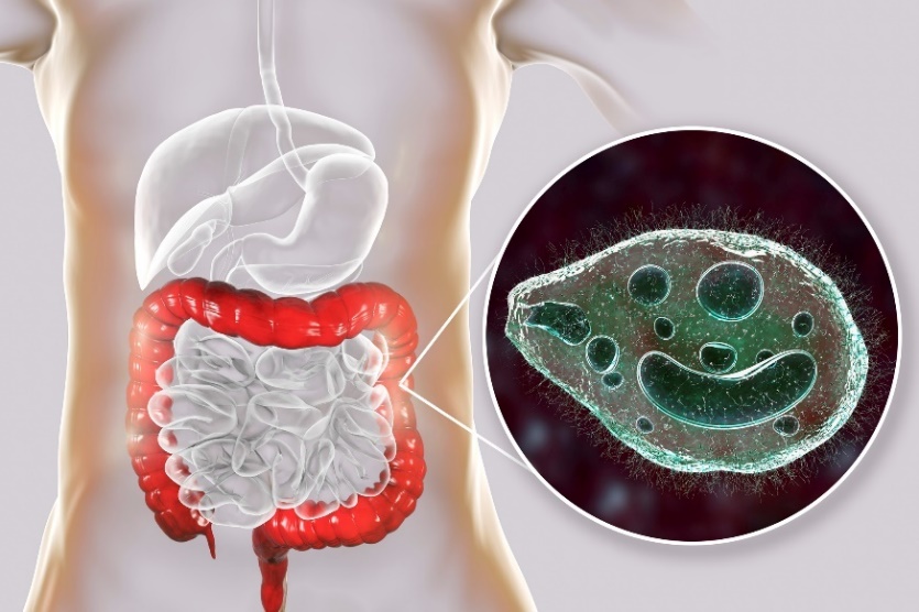 Balantidium coli - parazīts, kas inficē cilvēka gremošanas trakta resno zarnu.