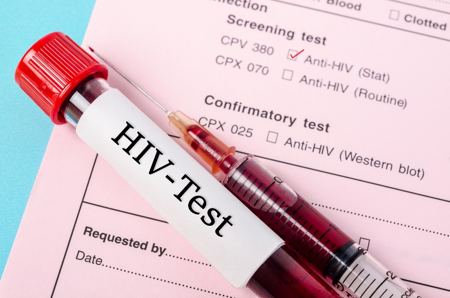 Diagnostikas tests, lai noteiktu anti-HIV antivielu klātbūtni pacienta asins paraugā.