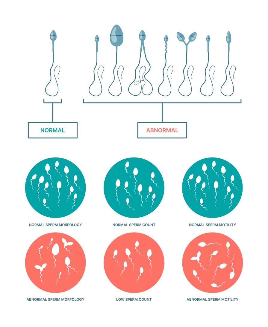 Spermatozoīdu fizioloģiskais un patoloģiskais stāvoklis. Spermatozoīdu morfoloģija, skaits un kustīgums.