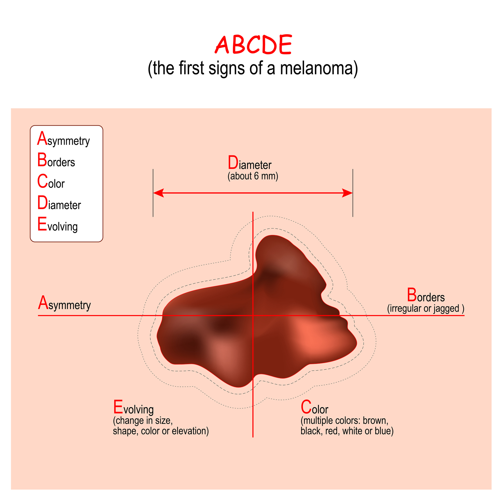 ABCDE algoritms