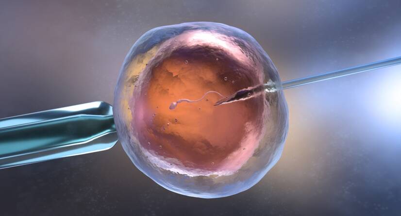 In vitro apaugļošana IVF. Avots: Getty Images